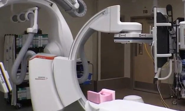 Los factores de riesgo de accidente cerebrovascular aumentan entre los jóvenes, advierten los médicos