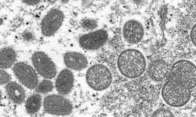 La viruela del mono probablemente se transmitió por sexo en 2 raves en Europa, dice un experto