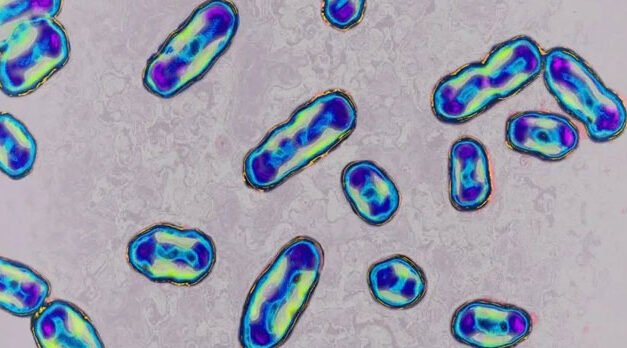 Se ha confirmado un nuevo caso de peste bubónica en humanos en EE.UU; van tres en el año