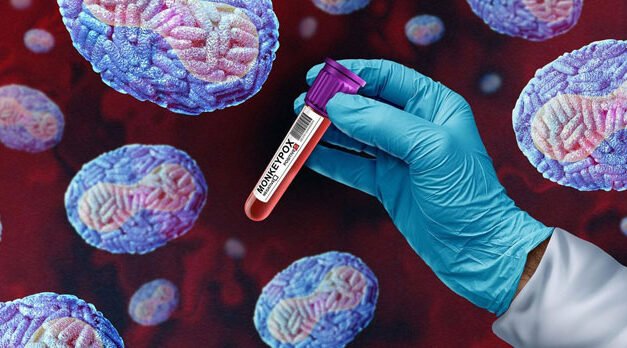 La OMS declara la emergencia sanitaria global por el mpox o viruela del mono