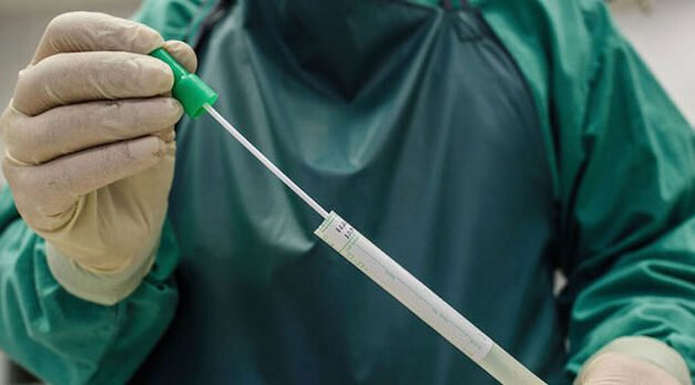 CDC confirman un caso de gripe aviar humana H5 que no parecía afectar a animales