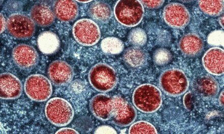 Las autoridades sanitarias de California informan del primer caso conocido de una nueva forma de MPOX en EE. UU.