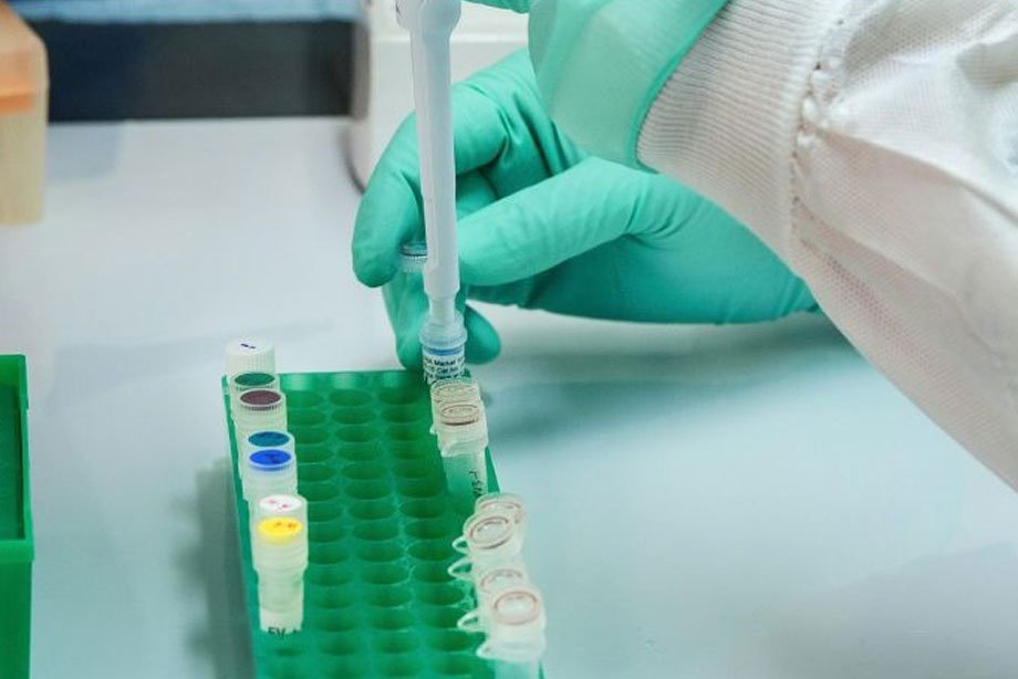 Reportan 150 casos de Metapneumovirus en Sinaloa