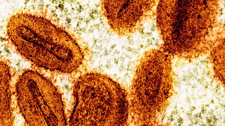 Dos científicos acusados ​​de introducir el virus mpox desactivado en Estados Unidos y mentir a las autoridades.